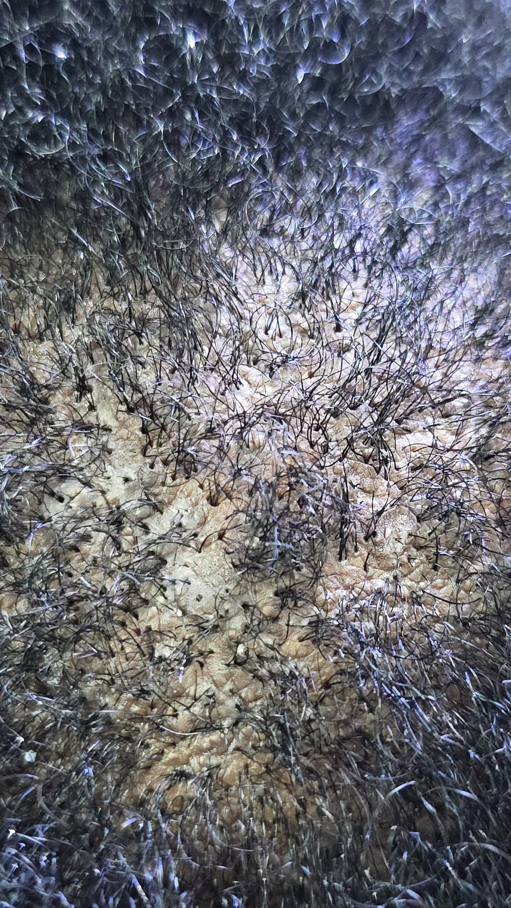 Scalp Examination
