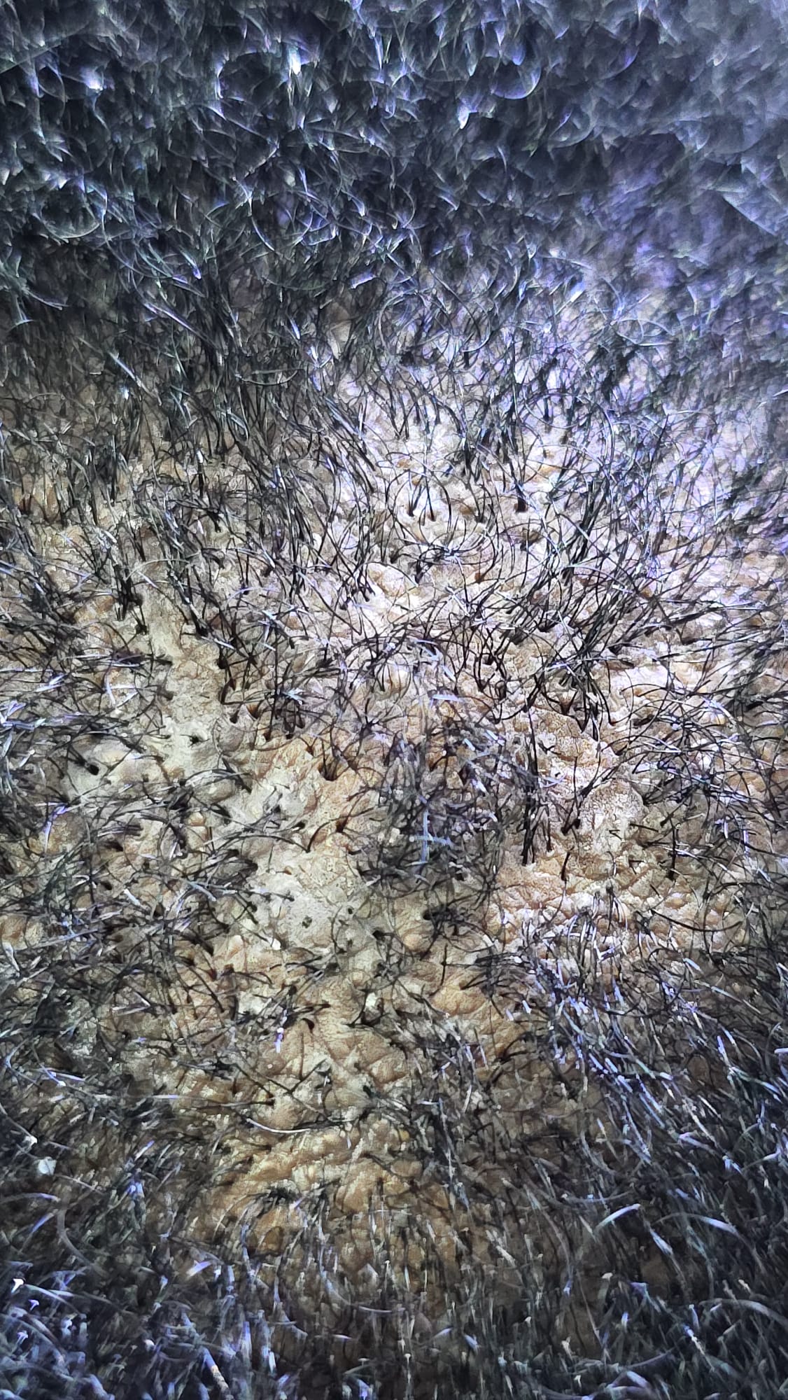 Scalp Examination