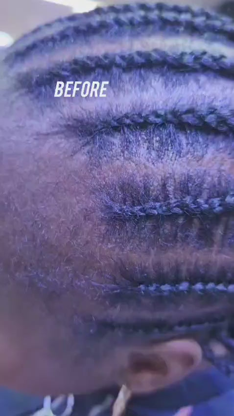 Bald patches edges kit