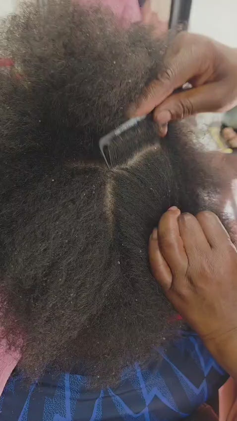 Scalp Examination