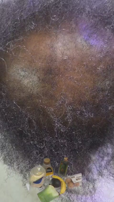 6-in-1 Detox Treatement for Dandruff, Itchy Scalp & Rash