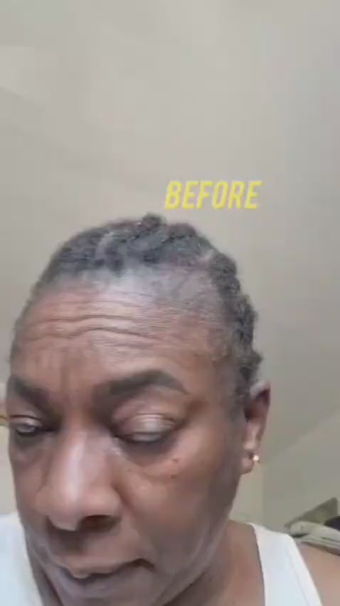 Inflammation and Itchy Scalp Combo, FFA and CCCA