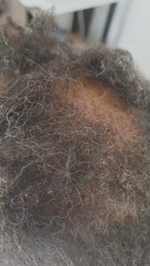 Scalp Examination