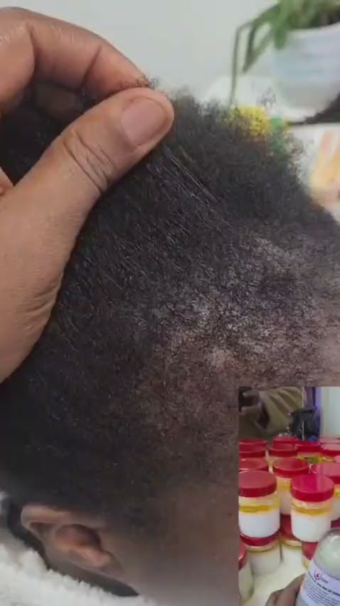 Edges & Shedding Hair (but healthy scalp)